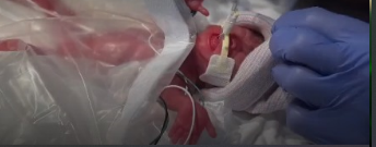 “Seiori’s Journey: From Tiny Miracle to Thriving Baby” “Seiori’s Journey: From Tiny Miracle to Thriving Baby”